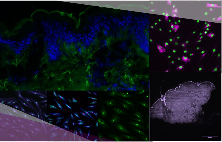 Anti aging in vitro tests : observation of protein in skin explant and NHDF Dermal Fibroblasts