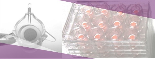 Biological models skin explants Nativeskin, innovative human skin model for penetration test