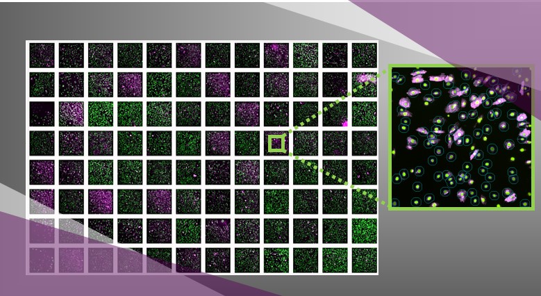 Live cell screening of active ingredients Arrayscan cellomics in 96 wells plate