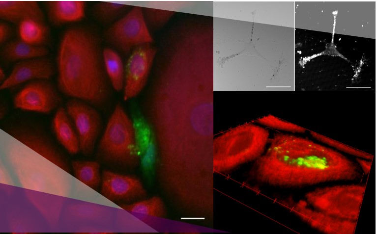 pigmentation skin in vitro test : melanin transfer from melanocytes to keratinocytes in coculture