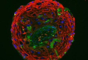 Epidermal Spheroid composed of primary keratinocytes and melanocytes labelled by immunofluorescence