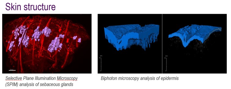 SPIM and Biphoton skin structure analysis