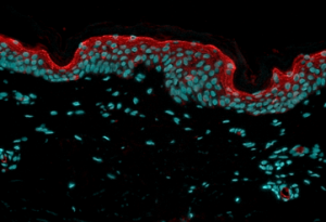 immunofluorescent labelling on skin explant