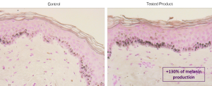 melanin quantification ex vivo on skin explant