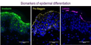ex vivo study of epidermal differentiation