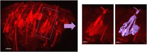 Separation and analysis of each sebaceous gland in the epidermis