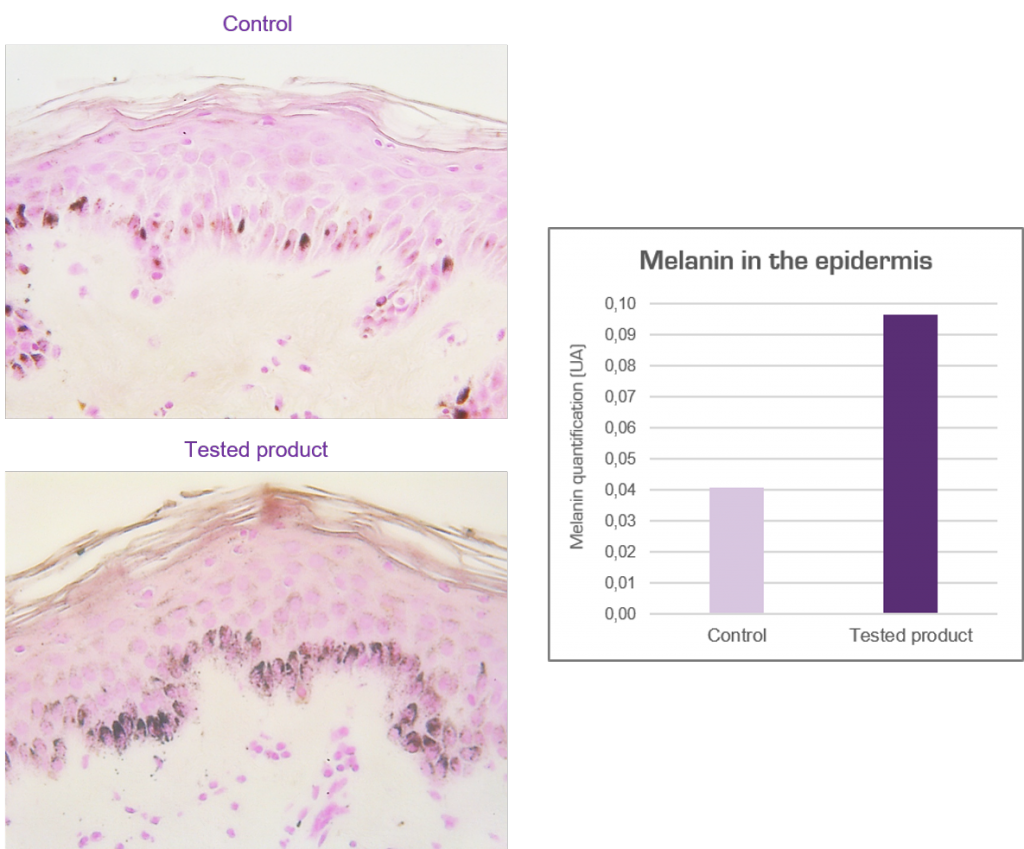 Melanin histology in skin explant