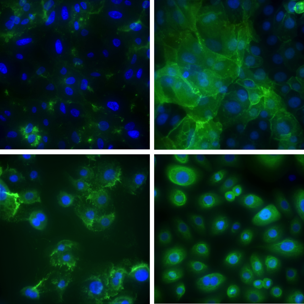 Keratinocytes imaging