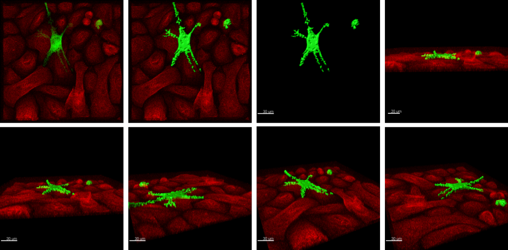 Melanocyte dendricity quantification