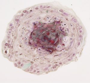 Epidermal spheroid 