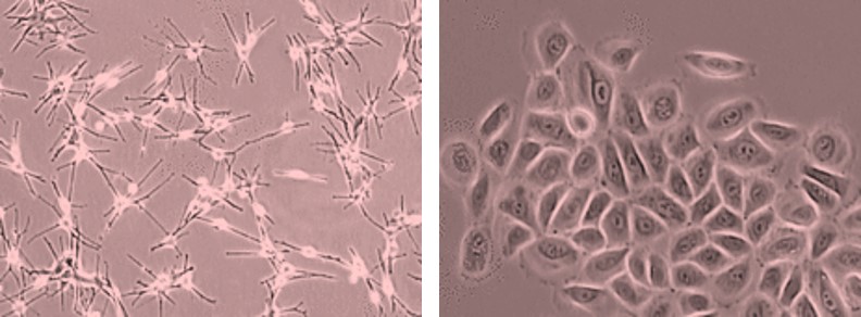 Melanocyte keratinocyte culture