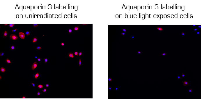 Aquaporine 3 labelling NHEK blue light moisturizing