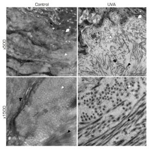 transmission electron microscopy dermis analysis