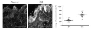 Protease activity in skin explant