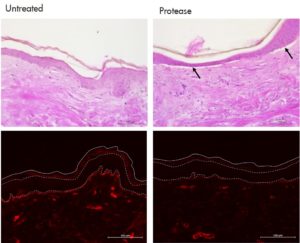 Digestion in the dermoepidermal junction Collagen in skin explant