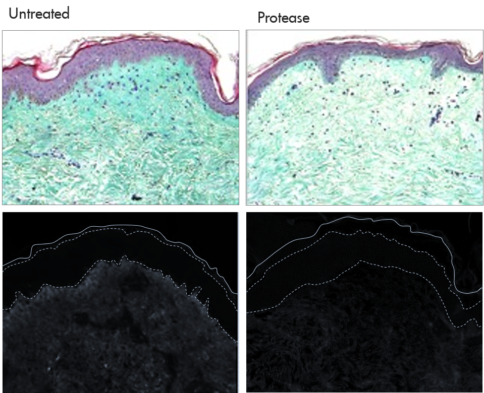 Digestion in the dermis Collagen in skin explant