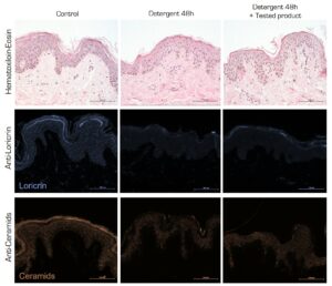 Skin regeneration after alteration of the barrier function with a dertergent