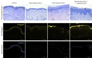 Skin regeneration after alteration of the barrier function by stripping