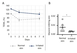 TEWL and glycerol content in sensitive skin