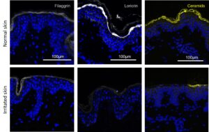 Marker of the skin barrier function