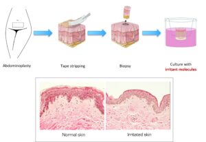 skin explant exposed to irritant stress