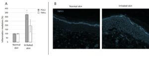 Neuroinflammation in the skin